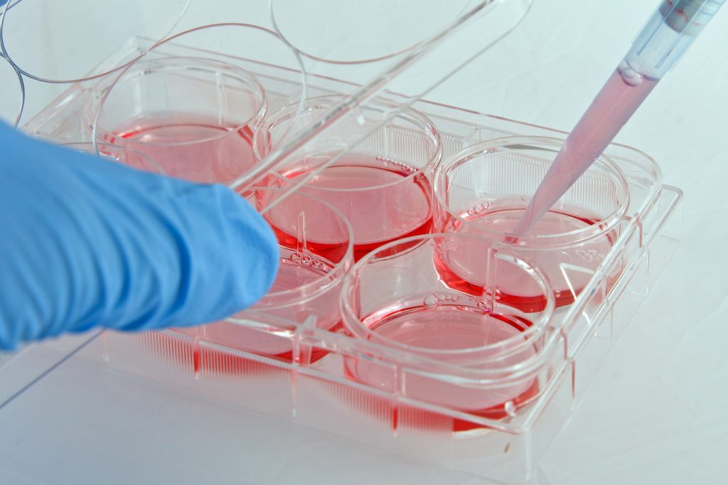 Stem Cell Treatment For Age-Related Macular Degeneration Shows Promise